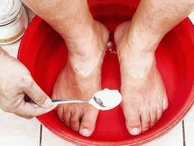 sodové koupele na houby