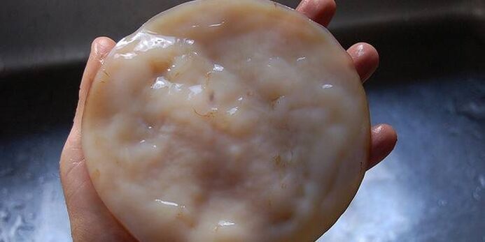 Kombucha na plíseň nehtů