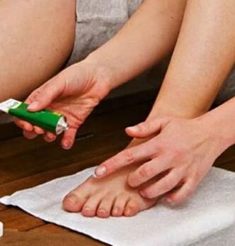 Použití terapeutické masti k porážce nehtu palce u nohy houbou